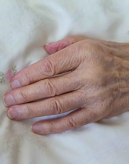bony hand old dying person